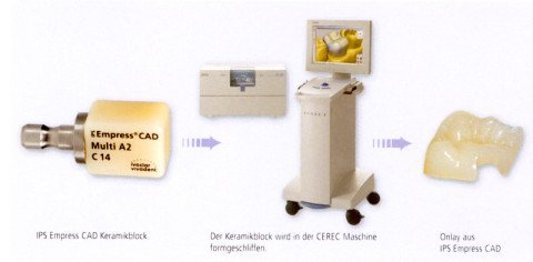 Cerec 3D System