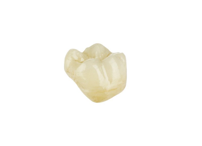 Zahnoberflächen